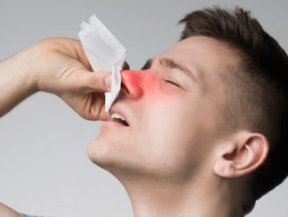 Sangrado de nariz, una constante en verano: cómo prevenirlo y tratarlo